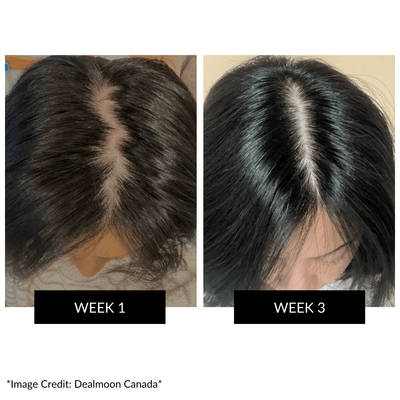 CurrentBody Skin LED Hair Regrowth Device.Hongmall