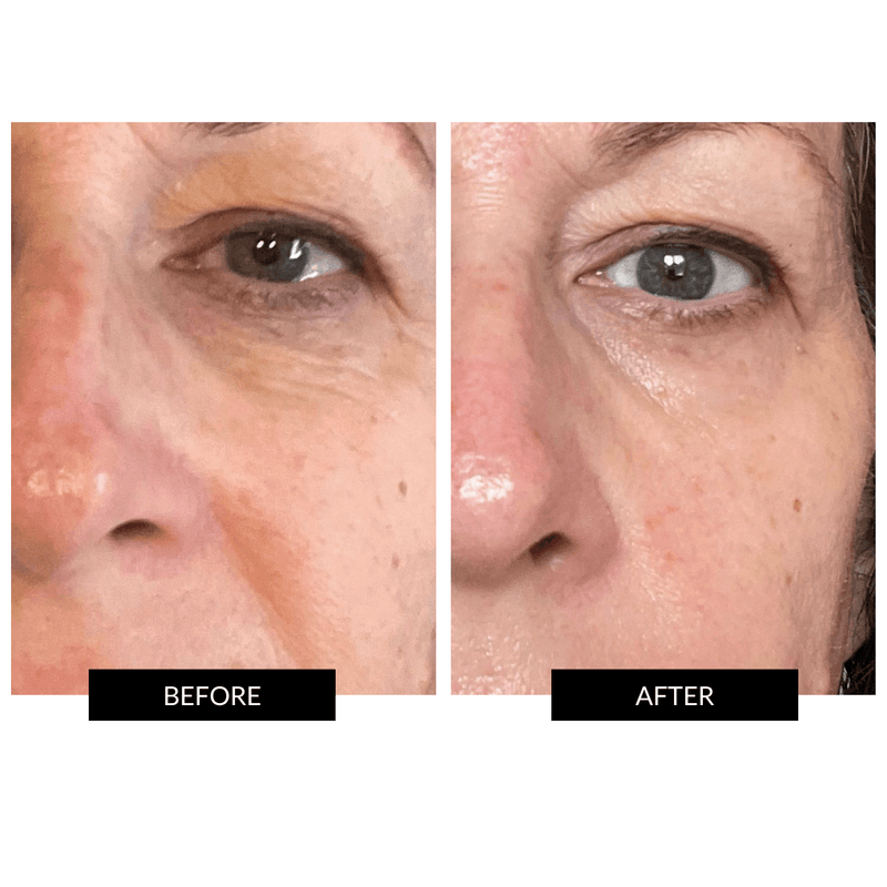 CurrentBody Skin LED Light Therapy Mask + CurrentBody Skin Hydrogel Mask (5 Pack)