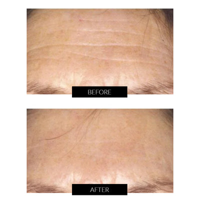 NuFACE Mini Facial Toning Device + CurrentBody Skin LED Mask