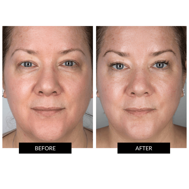 CurrentBody Skin LED Light Therapy Mask + CurrentBody Skin Hydrogel Mask (5 Pack)