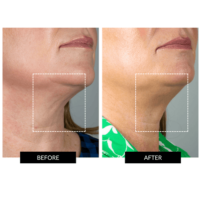 CurrentBody Skin RF Device + Sarah Chapman Overnight Facial
