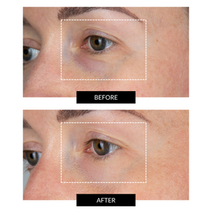 CurrentBody Skin Hydrate & Regenerate Eye Kit