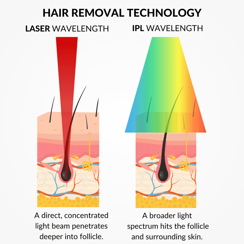Laser Hair Removal Device At Home Laser Hair Removal Machine