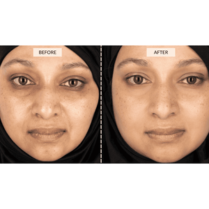 CurrentBody Skin Silver LED Beauty Gift Set