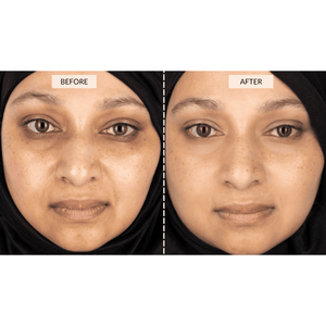 CurrentBody Skin Limited Edition LED Beauty Gift Set
