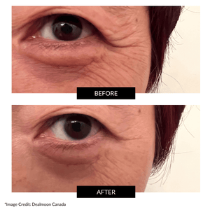 CurrentBody Skin RF Radio Frequency Device & NuFACE Mini Facial Toner