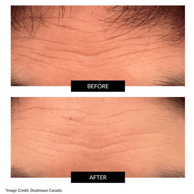 CurrentBody Skin RF Radio Frequency Device & NuFACE Mini Facial Toner