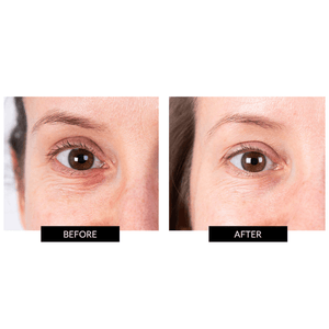 CurrentBody Skin Eye Perfector and Dr. Harris Anti-Wrinkle Sleep Mask