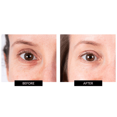 CurrentBody Skin LED Eye Perfector & NuFACE Mini Facial Toning Starter Kit