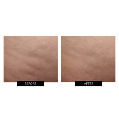 NuBODY Skin Toning Kit