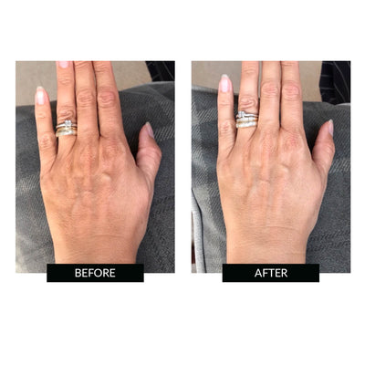CurrentBody Skin LED Hand Perfector.Hongmall