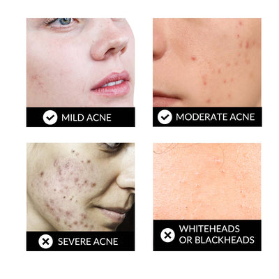 Dermalux Flex MD.Hongmall