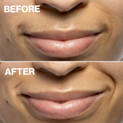 DERMAFLASH Mini Precision Peach Fuzz Removal Device