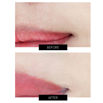 FREE JOVS Mini Hair Removal Device Worth $329