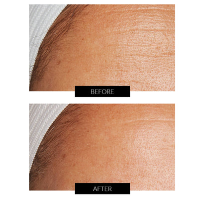 Lancer Skincare The Method: Cleanse Normal-Combination Skin 120ml