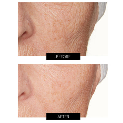 Lancer Skincare The Method: Cleanse Normal-Combination Skin 120ml