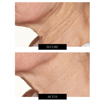 Lancer Skincare Intensive Night Treatment with Hylaplex® and Marula Oil 50ml