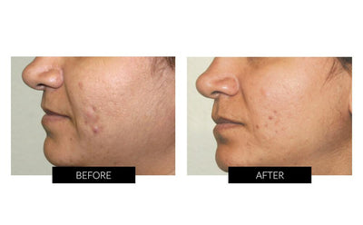 CurrentBody Skin Face & Neck Kit (worth $900).Hongmall