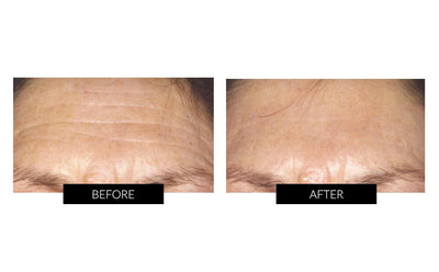 CurrentBody Skin Face & Neck Kit (worth $900).Hongmall
