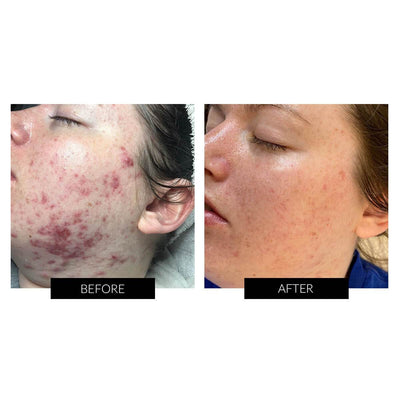 Dermalux Flex MD.Hongmall