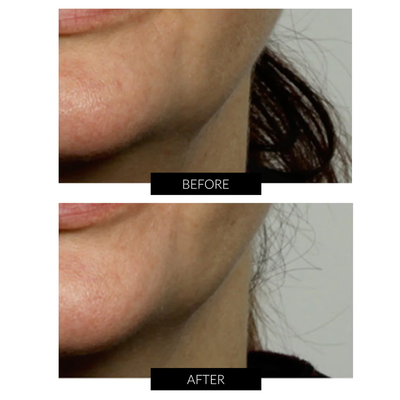 NuFACE Mini Facial Toning Device & Clarisonic Mia Smart Set