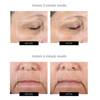 NuFACE Fix Line Smoothing Device.Hongmall