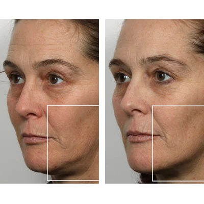 NuFACE Mini Facial Toning Device