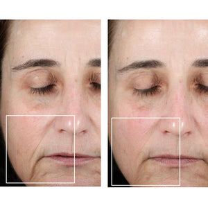 NuFACE Mini Facial Toning Device