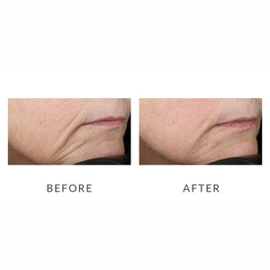 NuFACE Trinity Facial Toning Device Before and After Review