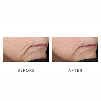 NuFACE Trinity Facial Toning Device Before and After Review